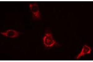 Immunofluorescence (fixed cells) (IF/ICC) image for anti-Amyloid beta (A4) Precursor Protein (APP) (C-Term) antibody (ABIN6259922)