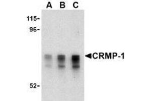 Western blot analysis of CRMP1 in Caco-2 cell lysate with AP30243PU-N CRMP1 antibody at (A) 1, (B) 2 and (C) 4 μg/ml. (CRMP1 Antikörper  (Intermediate Domain))