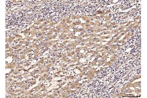 IHC analysis of MYD88 using anti-MYD88 antibody (ABIN7602189). (MYD88 Antikörper  (AA 62-296))