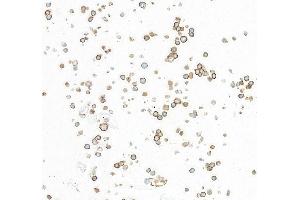 Immunocytochemistry (ICC) image for anti-CD86 (CD86) (AA 24-245) antibody (ABIN7795646) (Rekombinanter CD86 Antikörper  (AA 24-245))
