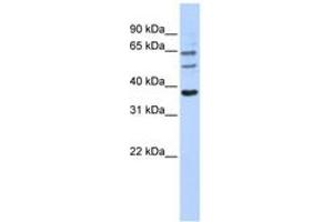 Image no. 1 for anti-UDP Glucuronosyltransferase 1 Family, Polypeptide A9 (UGT1A9) (AA 108-157) antibody (ABIN6743112)