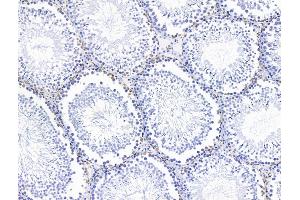ABIN7094705 and ABIN7098756 at 1/100 staining Rat testis tissue by IHC-P.