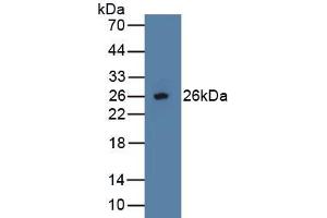 Detection of Recombinant OPG, Human using Polyclonal Antibody to Osteoprotegerin (OPG) (Osteoprotegerin Antikörper  (AA 1-196))