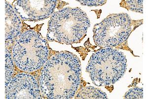 ABIN6264044 and ABIN6273287 at 1/100 staining Mouse testis tissue by IHC-P. (Parvin, beta Antikörper  (C-Term))