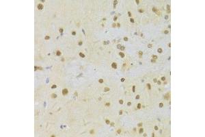 Immunohistochemistry (Paraffin-embedded Sections) (IHC (p)) image for anti-Hepatoma-Derived Growth Factor (HDGF) (AA 1-240) antibody (ABIN6141694)