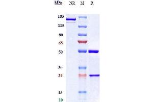 Anti- Human/Mouse/Monkey CTGF( Pamrevlumab) In Vivo Mab on SDS-PAGE under reducing (R) condition. (Rekombinanter CCN2 (Pamrevlumab Biosimilar) Antikörper)