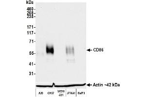 Western Blotting (WB) image for anti-CD86 (CD86) (AA 24-245) antibody (ABIN7795646) (Rekombinanter CD86 Antikörper  (AA 24-245))