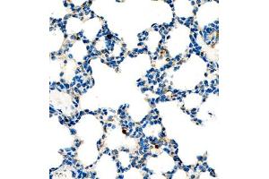 Immunohistochemistry of paraffin embedded mouse lung using P4H (ABIN7074215) at dilution of 1:700 (400x lens) (HIF Prolyl Hydroxylase Antikörper)