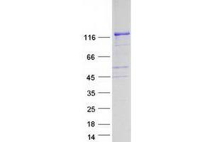FGD1 Protein (Myc-DYKDDDDK Tag)