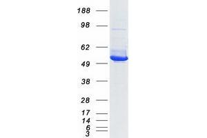 Validation with Western Blot