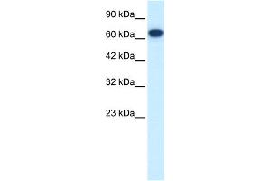 WB Suggested Anti-FLJ37300 Antibody Titration:  0.