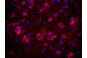 Formalin-fixed and paraffin-embedded rat brain labeled with Anti-CHRM4/mAChR M4 Polyclonal Antibody, Unconjugated (ABIN1387838) 1:200, overnight at 4°C, The secondary antibody was Goat Anti-Rabbit IgG, PE conjugated used at 1:200 dilution for 40 minutes at 37°C.