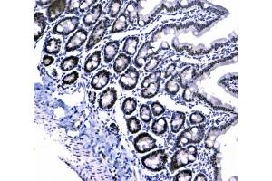 IHC testing of FFPE rat small intestine tissue with CBX3 antibody at 1ug/ml. (CBX3 Antikörper)