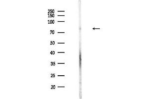 Western blot analysis of lysates from Hela cells(heat-shock,45 min treatment), using MARK3 Antibody at 1/1000 dilution.