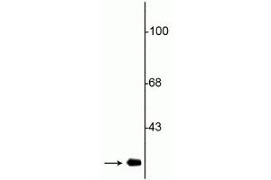 Western blot of rat striatal lysate showing specific immunolabeling of the ~28 kDa Cdk5 protein. (CDK5 Antikörper)