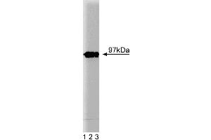 Western blot analysis of Eps8 on a lysate from mouse macrophages (RAW 264. (EPS8 Antikörper  (AA 628-821))