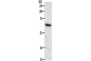 Western Blotting (WB) image for anti-Frizzled Family Receptor 4 (FZD4) antibody (ABIN2428931) (FZD4 Antikörper)