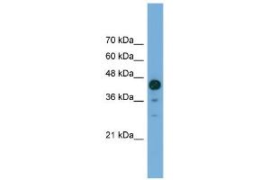 WB Suggested Anti-C2orf62 Antibody Titration: 0. (C2orf62 Antikörper  (C-Term))