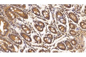 Detection of Surv in Porcine Small intestine Tissue using Monoclonal Antibody to Survivin (Surv)