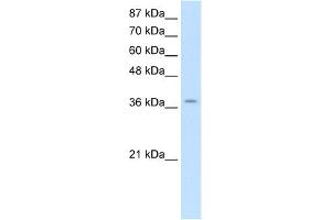 WB Suggested Anti-ZNF550 Antibody Titration:  2. (ZNF550 Antikörper  (Middle Region))