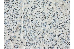 Immunohistochemical staining of paraffin-embedded Ovary tissue using anti-HDAC10mouse monoclonal antibody. (HDAC10 Antikörper)