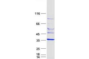 Western Blotting (WB) image for ELMO/CED-12 Domain Containing 2 (ELMOD2) protein (Myc-DYKDDDDK Tag) (ABIN2720148)