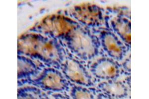 Used in DAB staining on fromalin fixed paraffin-embedded Intestine tissue (IL-37 Antikörper  (AA 46-218))