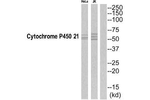 Western Blotting (WB) image for anti-Cytochrome P450, Family 21, Subfamily A, Polypeptide 2 (CYP21A2) (C-Term) antibody (ABIN1852650)