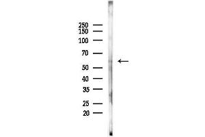 anti-Heat Shock Protein 70kDa Family, Member 13 (HSPA13) (C-Term) antibody