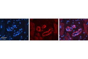 Rabbit Anti-SPRY2 Antibody   Formalin Fixed Paraffin Embedded Tissue: Human heart Tissue Observed Staining: Cytoplasmic in vasculature Primary Antibody Concentration: 1:100 Other Working Concentrations: 1:600 Secondary Antibody: Donkey anti-Rabbit-Cy3 Secondary Antibody Concentration: 1:200 Magnification: 20X Exposure Time: 0. (SPRY2 Antikörper  (N-Term))