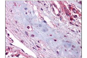 Human Lung, Chondrocytes: Formalin-Fixed, Paraffin-Embedded (FFPE) (UCMA Antikörper  (C-Term))