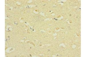 Immunohistochemistry of paraffin-embedded human brain tissue using ABIN7169924 at dilution of 1:100