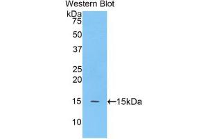 Western blot analysis of the recombinant protein. (MGEA5 Antikörper  (AA 695-814))