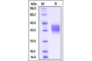 Mouse Fc gamma RIIB / CD32b, His Tag on SDS-PAGE under reducing (R) condition. (FCGR2B Protein (AA 40-217) (His tag))