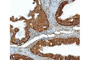 IHC analysis of IMPDH2 using anti-IMPDH2 antibody (ABIN7603063).