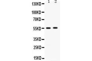 Western blot analysis of ALDH3A2 expression in rat liver extract ( Lane 1) and 22RV1 whole cell lysates ( Lane 2). (ALDH3A2 Antikörper  (AA 1-100))