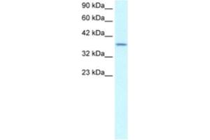 Western Blotting (WB) image for anti-SMAD, Mothers Against DPP Homolog 7 (SMAD7) antibody (ABIN2460353) (SMAD7 Antikörper)