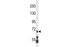 MLL5 antibody western blot analysis in HL-60 lysate. (MLL5/KMT2E Antikörper  (AA 93-120))