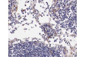 ABIN6267676 at 1/100 staining human lymph node tissue sections by IHC-P. (B-Cell Linker Antikörper  (pTyr96))