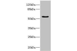 Western blot All lanes: CALCRantibody IgG at 5. (Calcitonin Receptor Antikörper  (AA 25-148))
