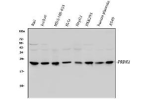 Western blot analysis of Peroxiredoxin 1 using anti-Peroxiredoxin 1 antibody (ABIN3043903).