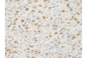 Immunohistochemistry (IHC) image for anti-Mismatch Repair Protein 2 (MSH2) (C-Term) antibody (ABIN7448673) (MSH2 Antikörper  (C-Term))