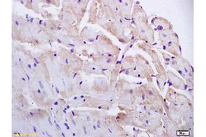 Formalin-fixed and paraffin embedded mouse heart labeled with Anti-PAP2B Polyclonal Antibody, Unconjugated (ABIN754228) at 1:200 followed by conjugation to the secondary antibody and DAB staining (PPAP2B Antikörper  (AA 241-311))