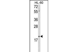 Western blot analysis of DLK2 Antibody (C-term) (ABIN652972 and ABIN2842616) in HL-60 cell line lysates (35 μg/lane). (DLK2 Antikörper  (C-Term))
