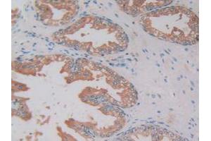 IHC-P analysis of Human Prostate Gland Tissue, with DAB staining. (Kallikrein 2 Antikörper  (AA 19-261))