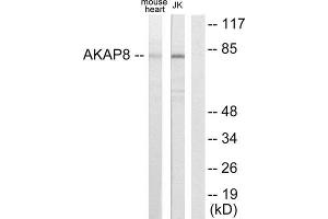 Western Blotting (WB) image for anti-A Kinase (PRKA) Anchor Protein 8 (AKAP8) (Internal Region) antibody (ABIN1848981) (AKAP8 Antikörper  (Internal Region))