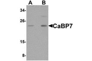 Western blot analysis of CaBP7 in Hela cell lysate with CaBP7 antibody at (A) 1 and (B) 2 μg/ml. (CABP7 Antikörper  (N-Term))