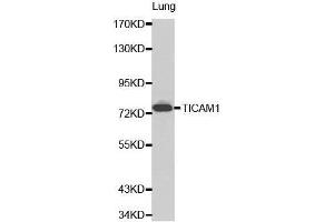 Western Blotting (WB) image for anti-Toll-Like Receptor Adaptor Molecule 1 (TICAM1) (AA 20-200) antibody (ABIN6215259) (TICAM1 Antikörper  (AA 20-200))
