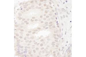 Immunohistochemistry (IHC) image for anti-Cancer Susceptibility Candidate 5 (CASC5) (AA 300-350) antibody (ABIN7448458) (CASC5 Antikörper  (AA 300-350))