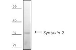 Western blot analysis of human Jurkat cell lysate, probed with Syntaxin 2 pAb. (STX2 Antikörper  (N-Term))